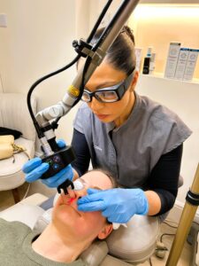 CO2 coolpeel laser dr selina clinics london